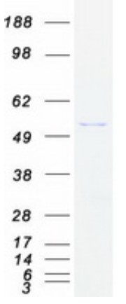 SDS-PAGE (EPHX1-5311H).jpg